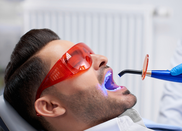 Why Might Dental Fillings Be Needed